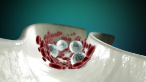 ASDキャリブレーションプレートを使用したバランス調整の方法は？